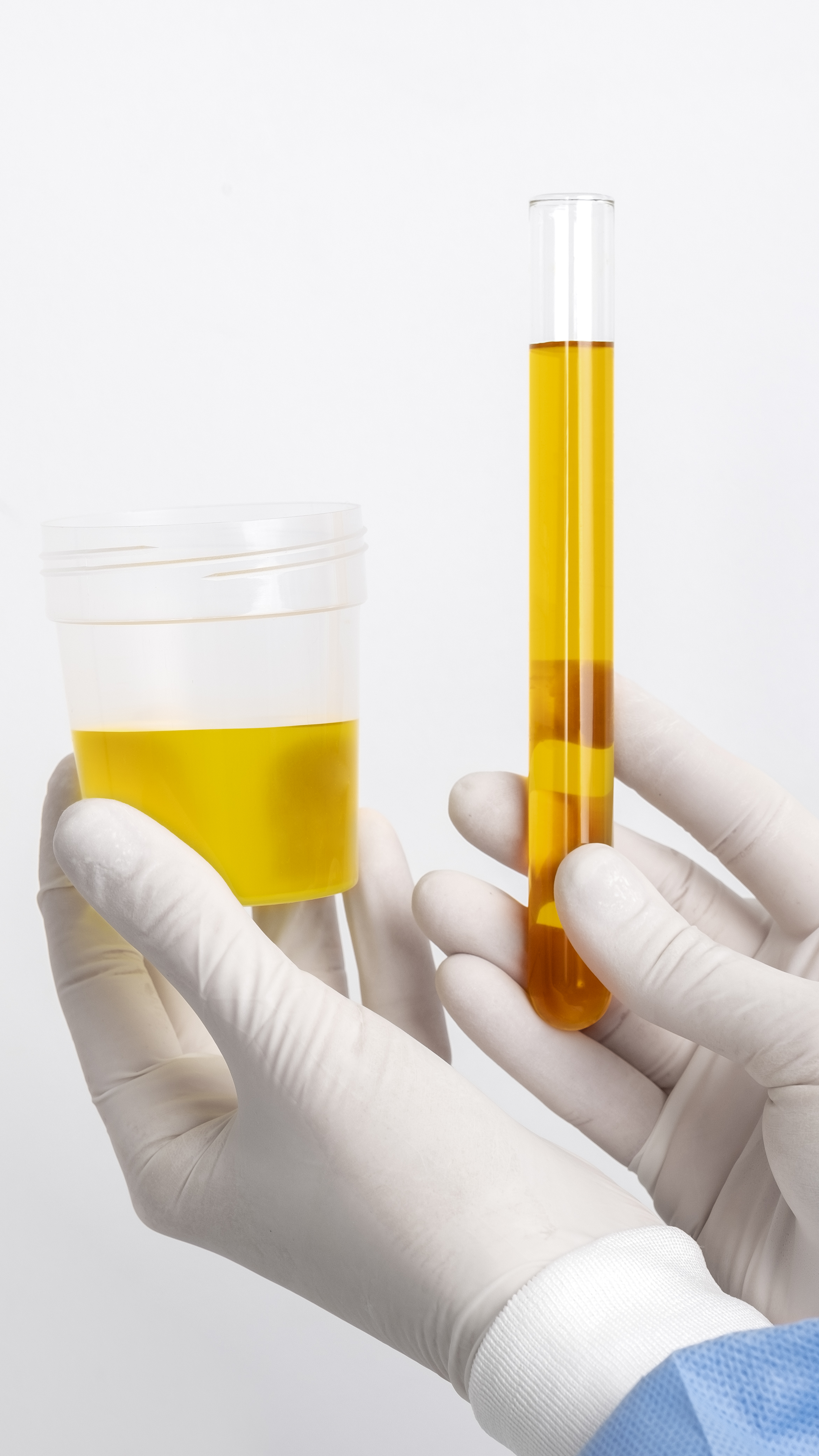 Sample Preparation